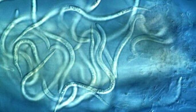 À quoi ressemblent les parasites nématodes dans le corps humain