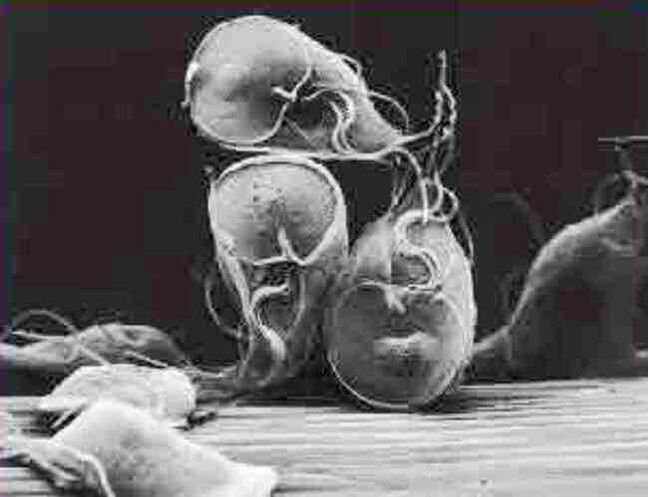 parasite protozoaire Giardia